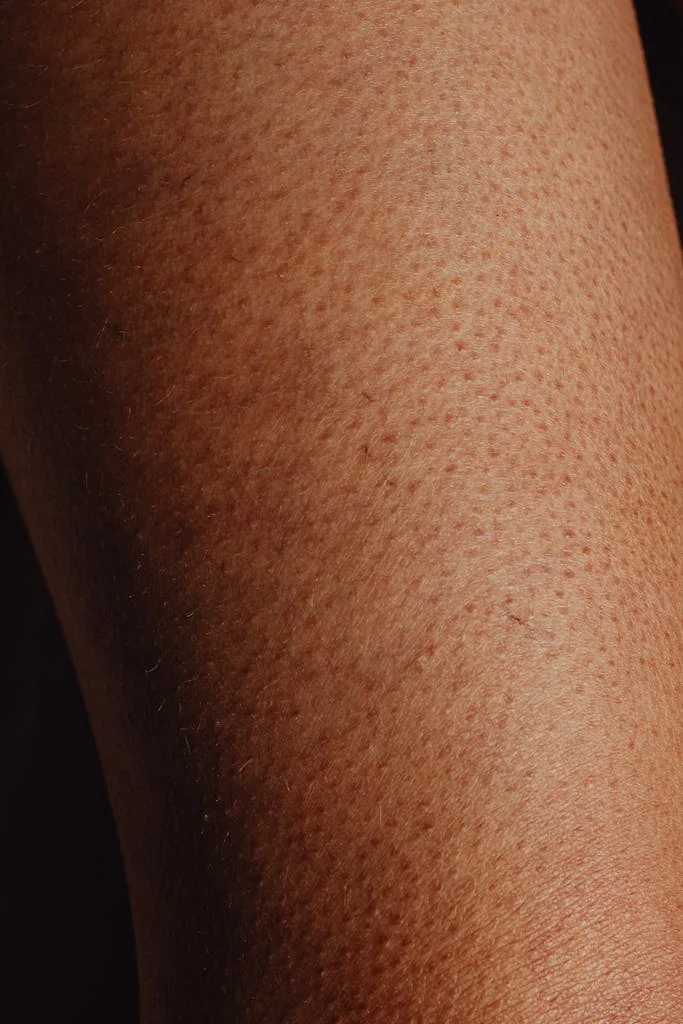Detailed shot showcasing goosebumps and the texture and natural appearance of human skin.